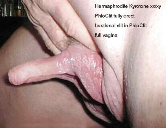 Hermaphrodite Huge Clit - Xxx Pics