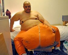 Man With Giant Scrotum