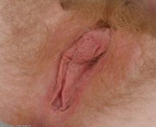 Pregnant women hairy vagina