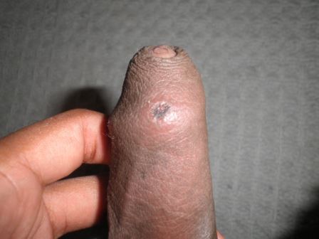 Penis after fucking